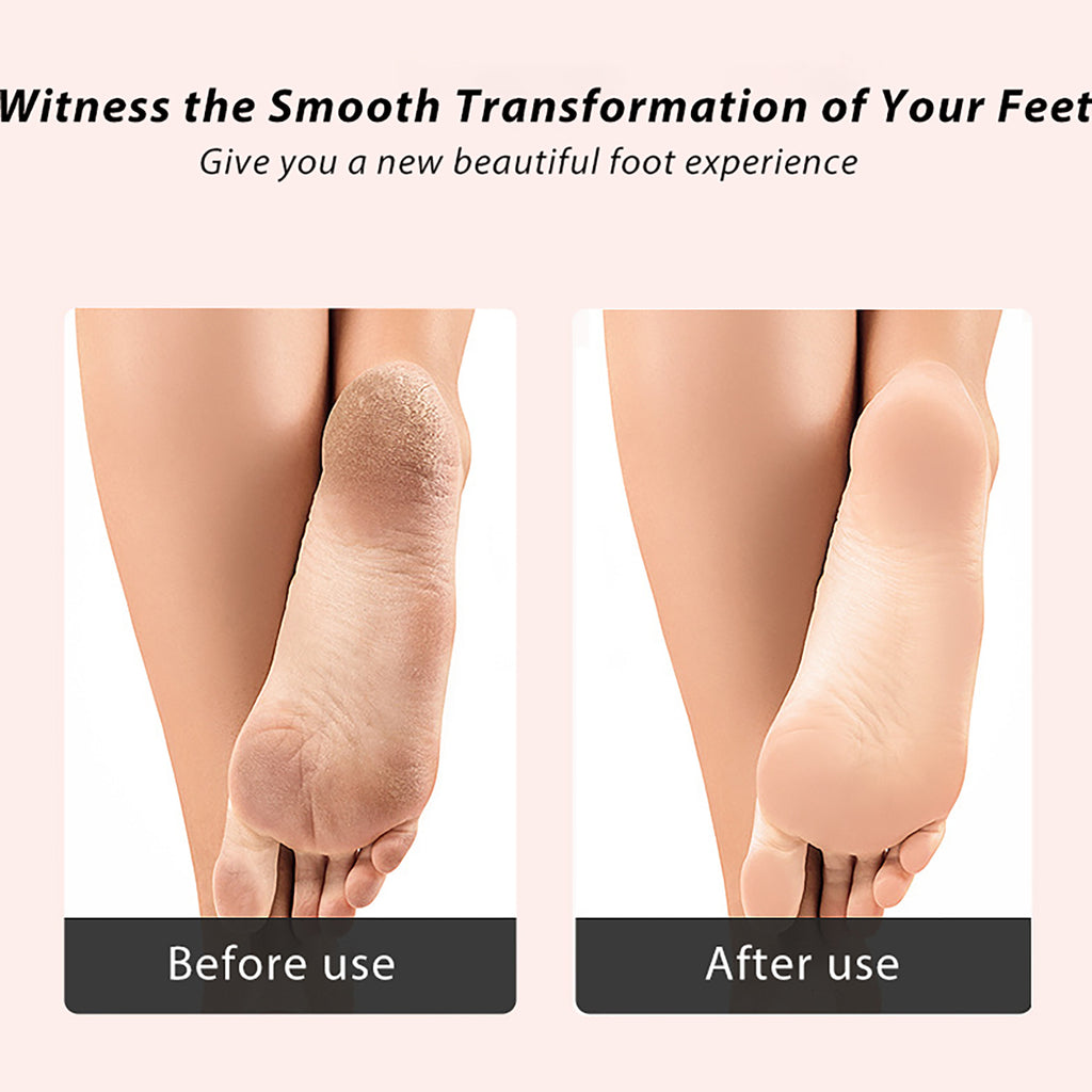 Heel Clean Pedicure Tools Callus Remover Foot Scrubber Foot File and Callus  Remover Feet Massage Brush Manicure Foot Care Tools
